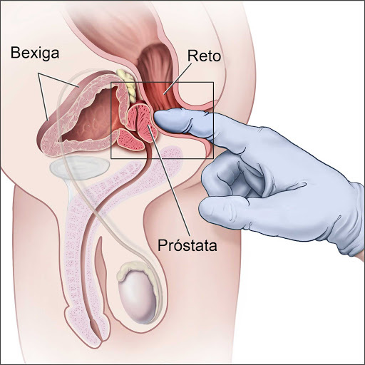 O que é a próstata